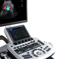 Diagnóstico médico 3/d 4/d Ultrassom sem fio Doppler sem fio